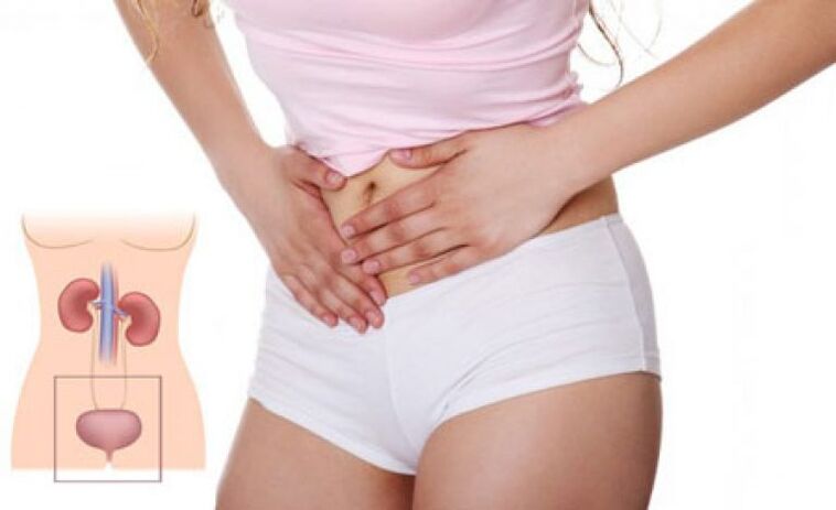Ee vun de Symptomer vun der Cystitis bei Fraen ass Schmerz am suprapubesche Beräich.